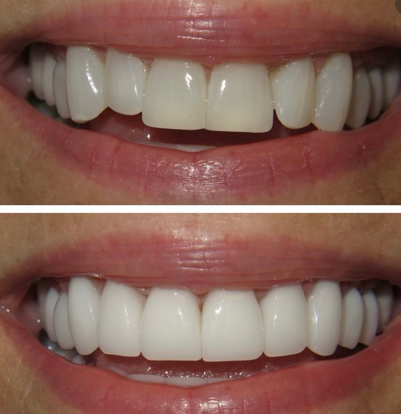tulsa cosmetic dentist