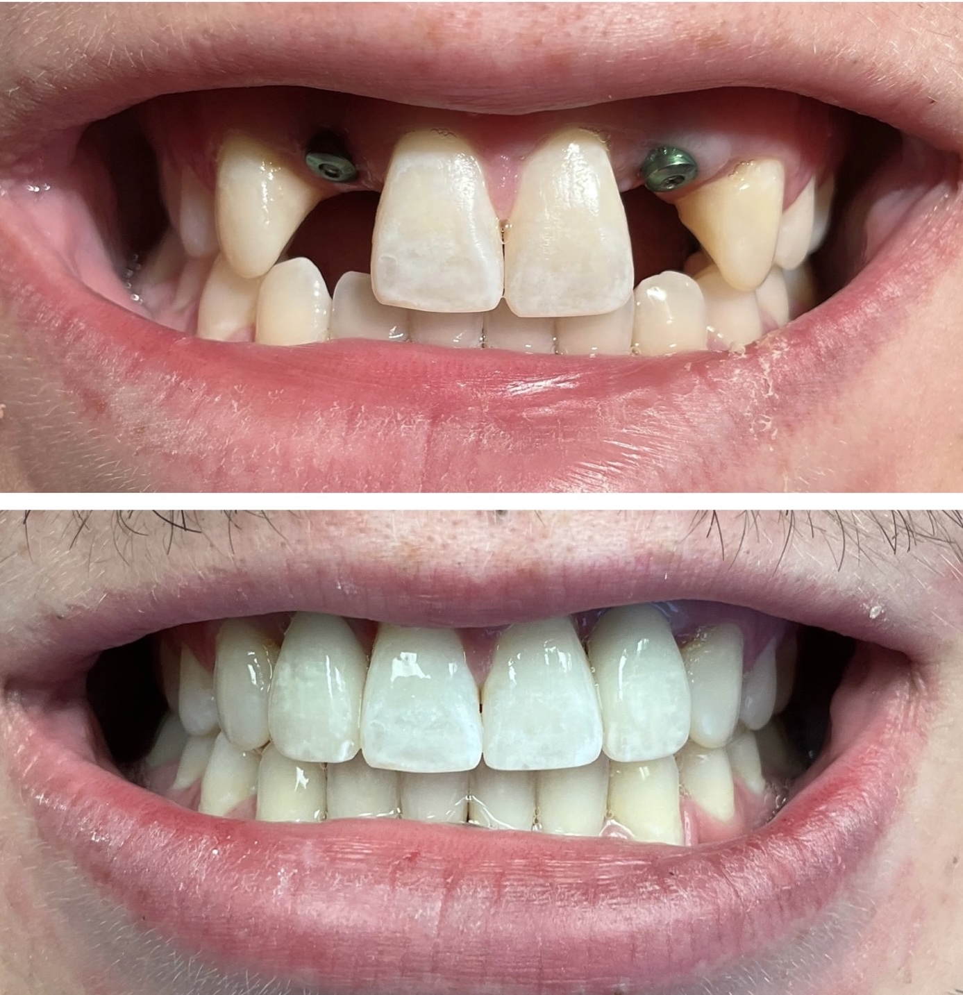 tulsa cosmetic dentist