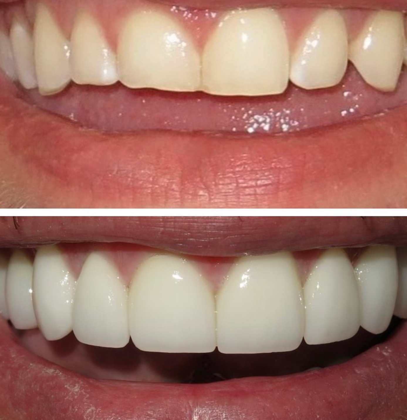 tulsa cosmetic dentist